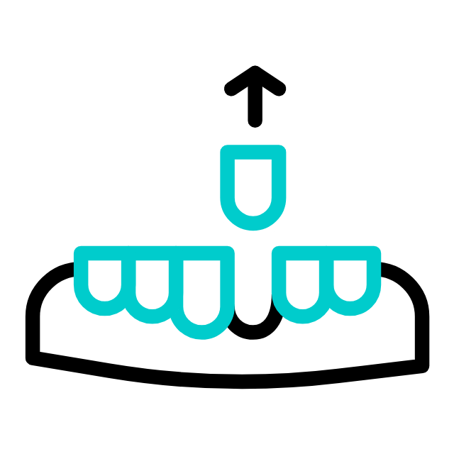 Tooth Extraction