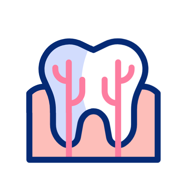 Root Canal Treatment