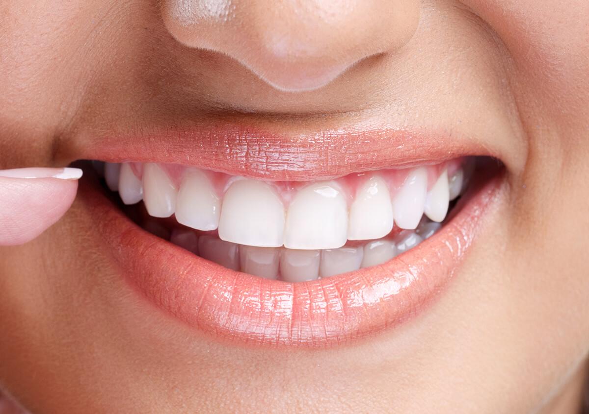 Cosmetic Dentistry