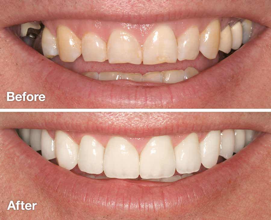 Cosmetic Dentistry