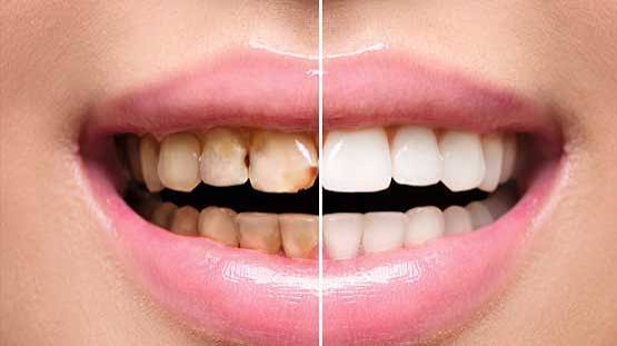 Cosmetic Dentistry