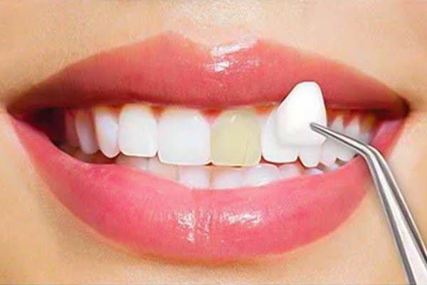 Cosmetic Dentistry