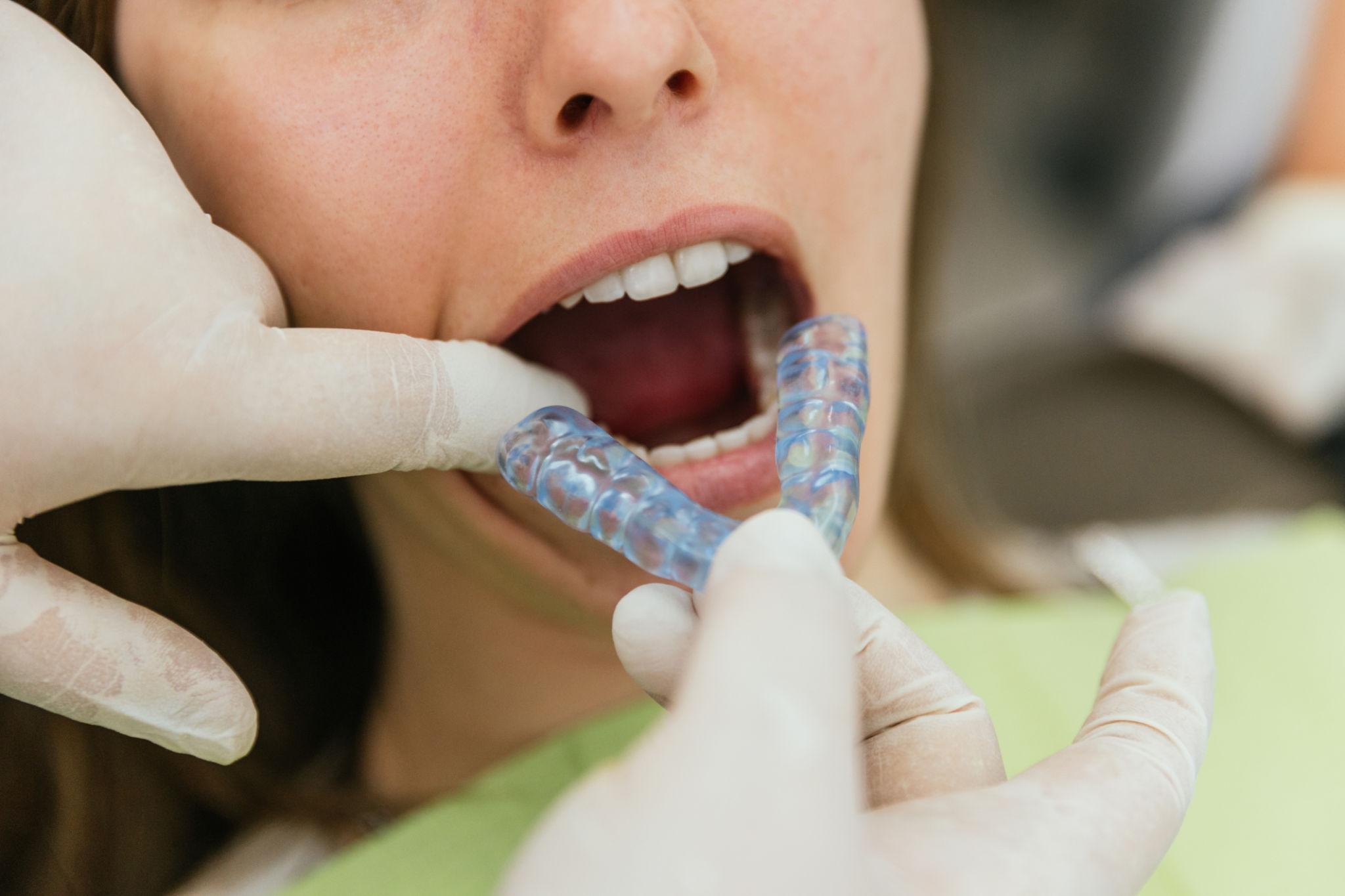 Cosmetic Dentistry