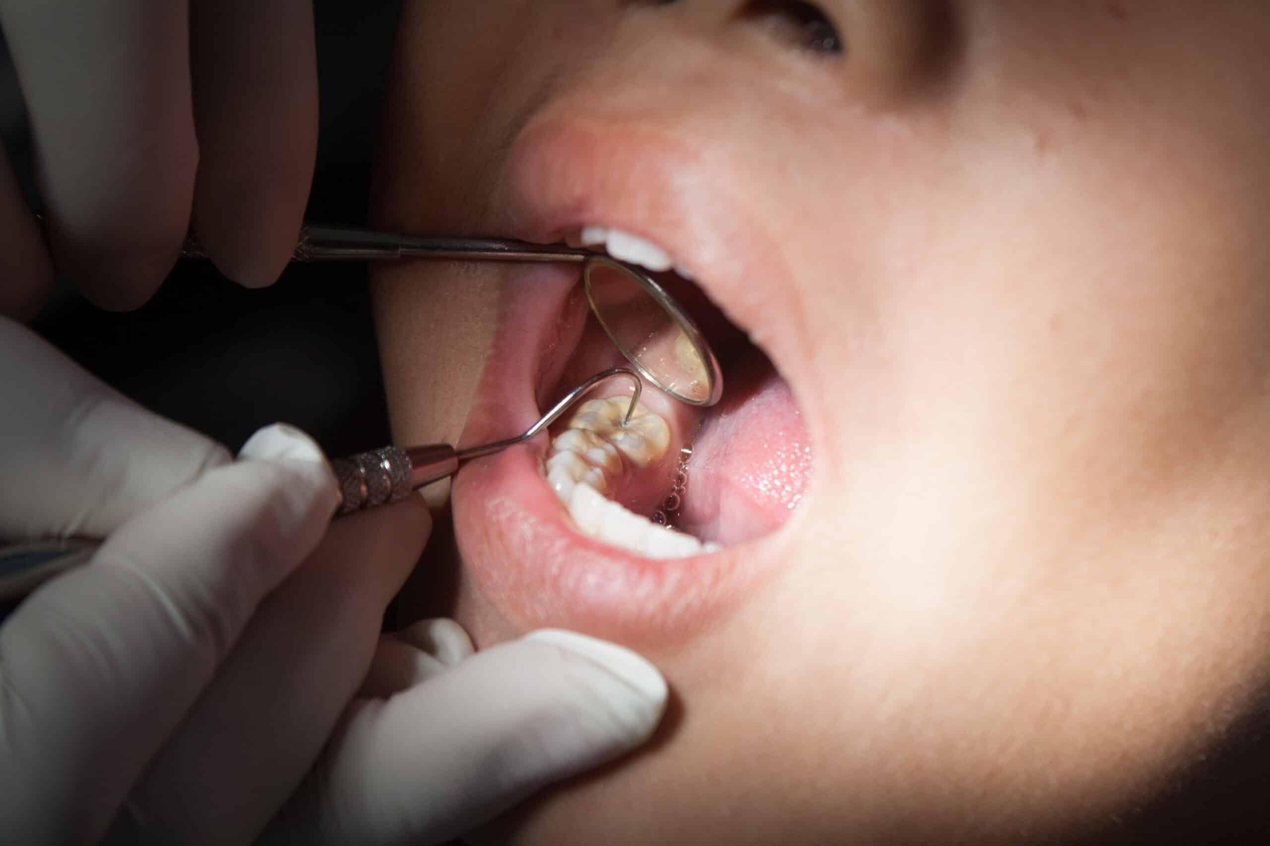 Cosmetic Dentistry