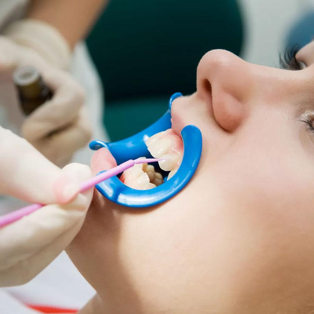 Cosmetic Dentistry