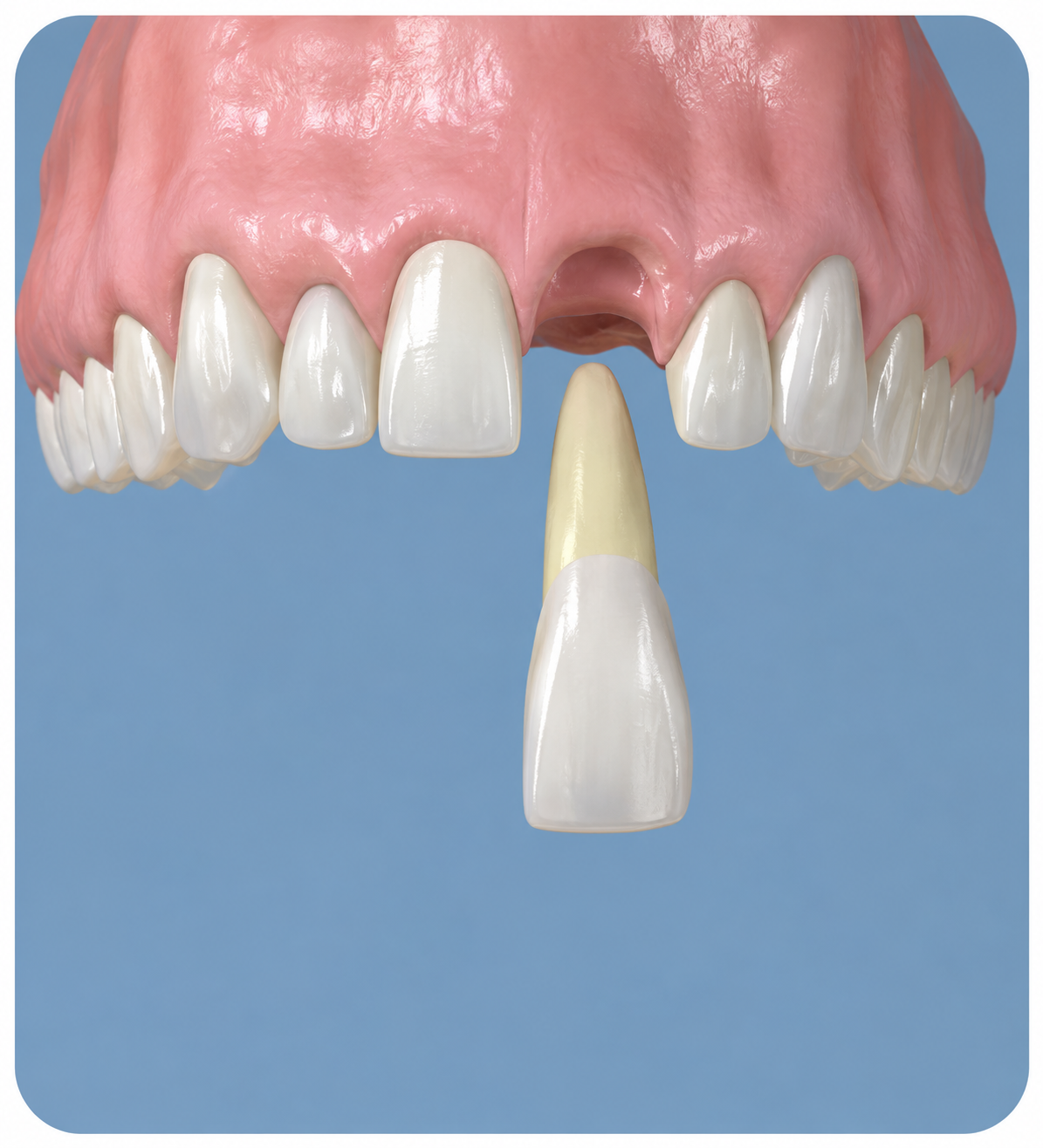 Cosmetic Dentistry