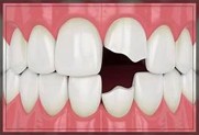 Cosmetic Dentistry