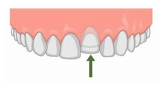 Cosmetic Dentistry