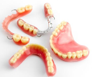 Complete Dentures