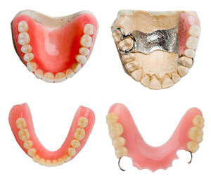 Complete Denture Treatment