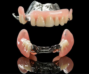 Removable Partial Dentures