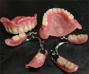 Removable Dental Prosthesis