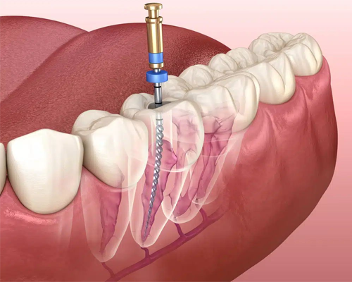 Cosmetic Dentistry
