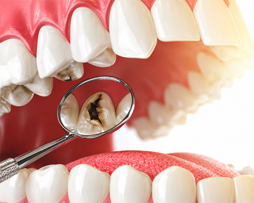 Cosmetic Dentistry