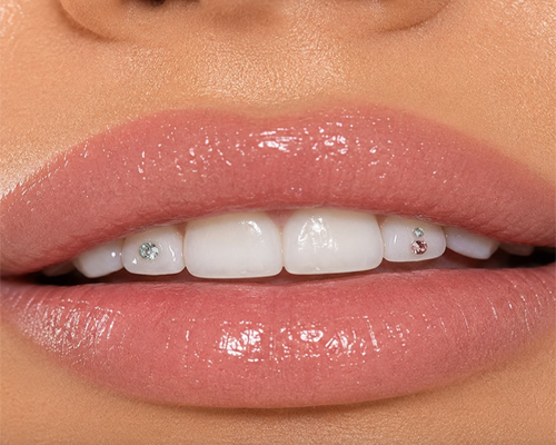 Cosmetic Dentistry
