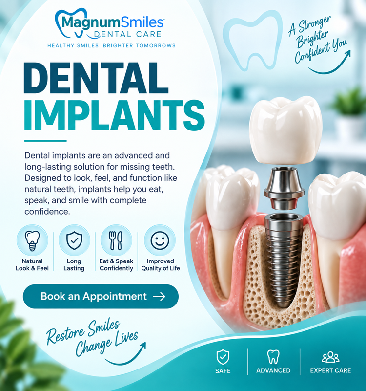 Dental Implants