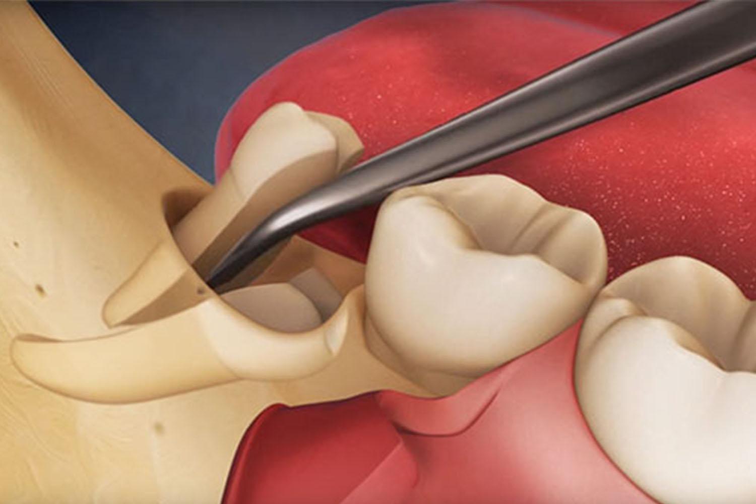 Cosmetic Dentistry