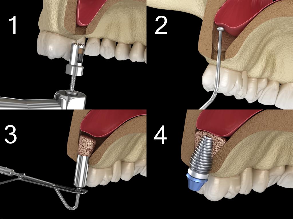 Cosmetic Dentistry