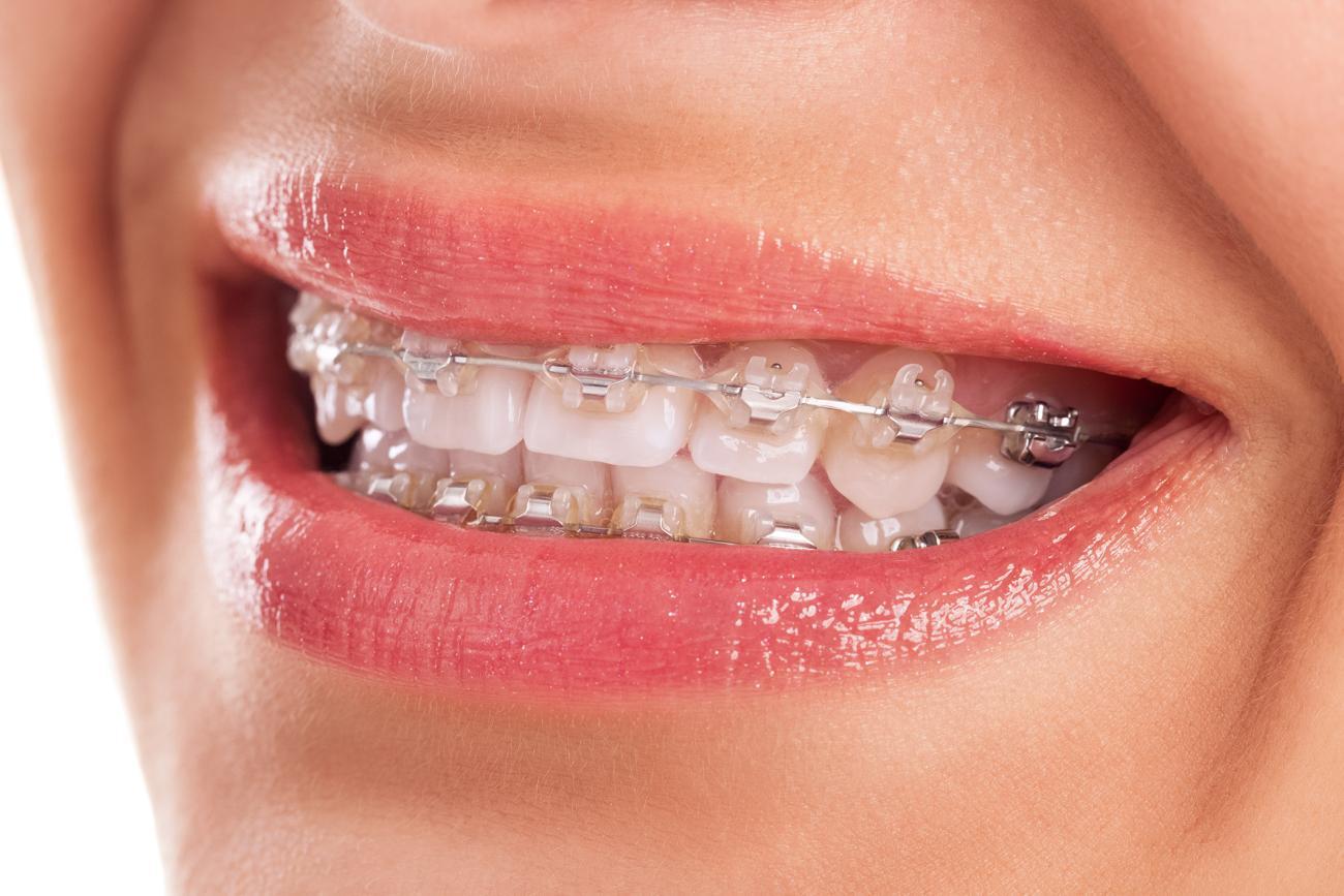 Cosmetic Dentistry