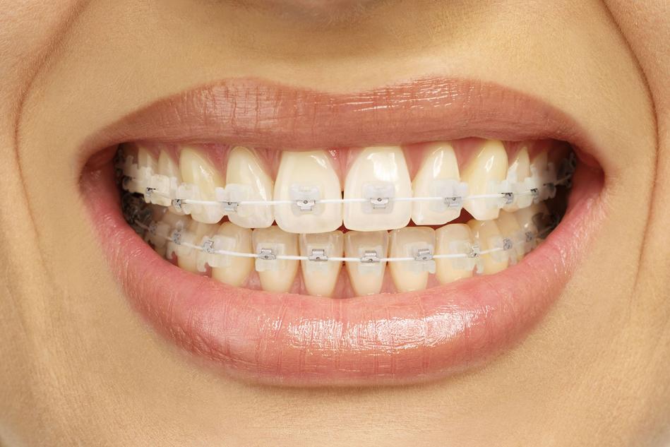 Cosmetic Dentistry
